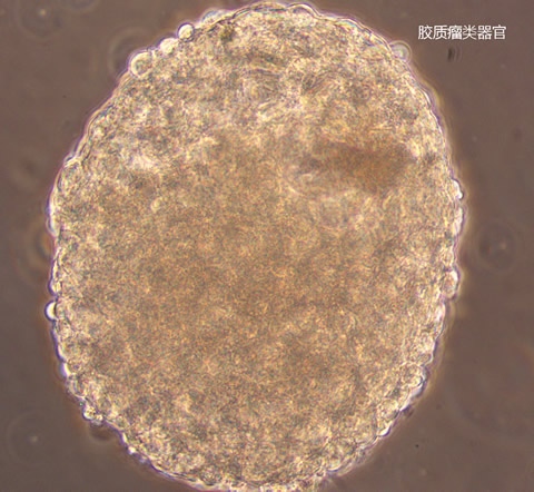 胶质瘤类器官-带文字.jpg